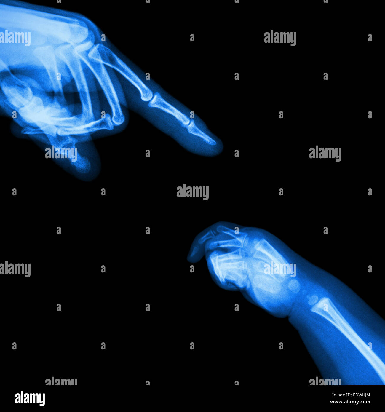 X-ray adult's hand point finger at upper side and baby's hand at lower side Stock Photo