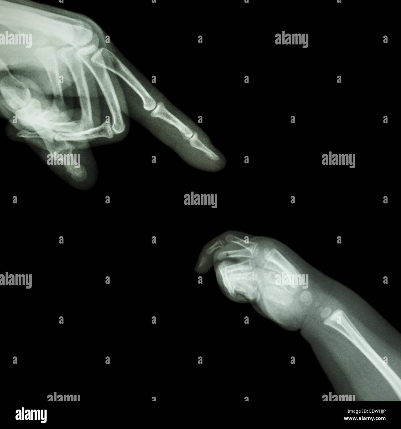X-ray adult's hand point finger at upper side and baby's hand at lower side Stock Photo