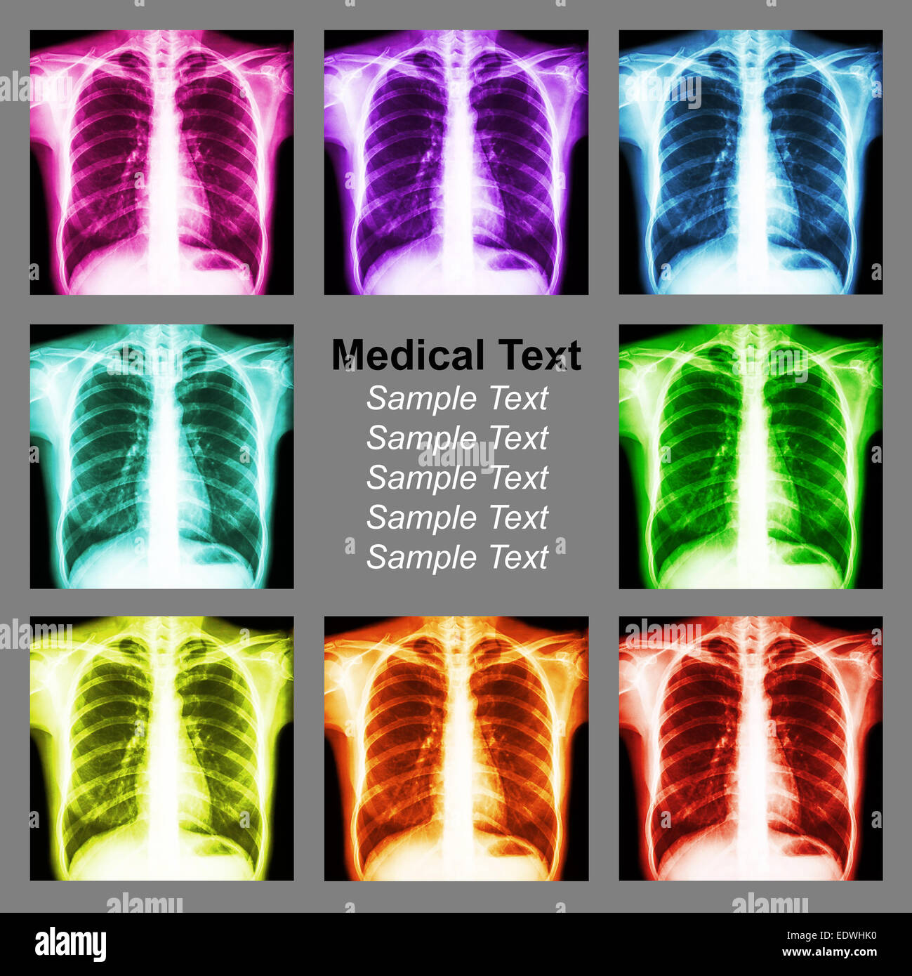 Multicolored chest x-ray background Stock Photo