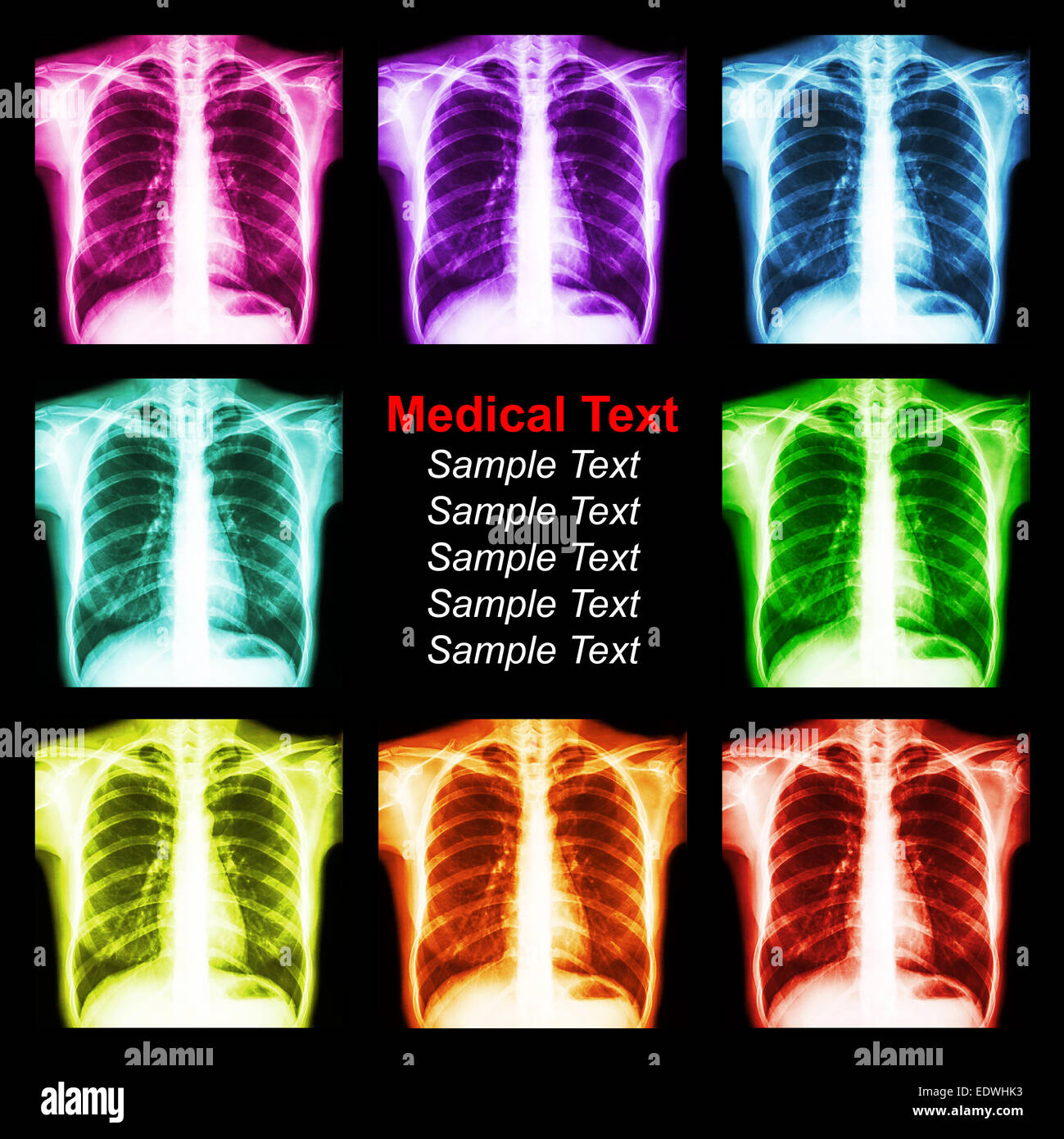 Multicolored chest x-ray background Stock Photo