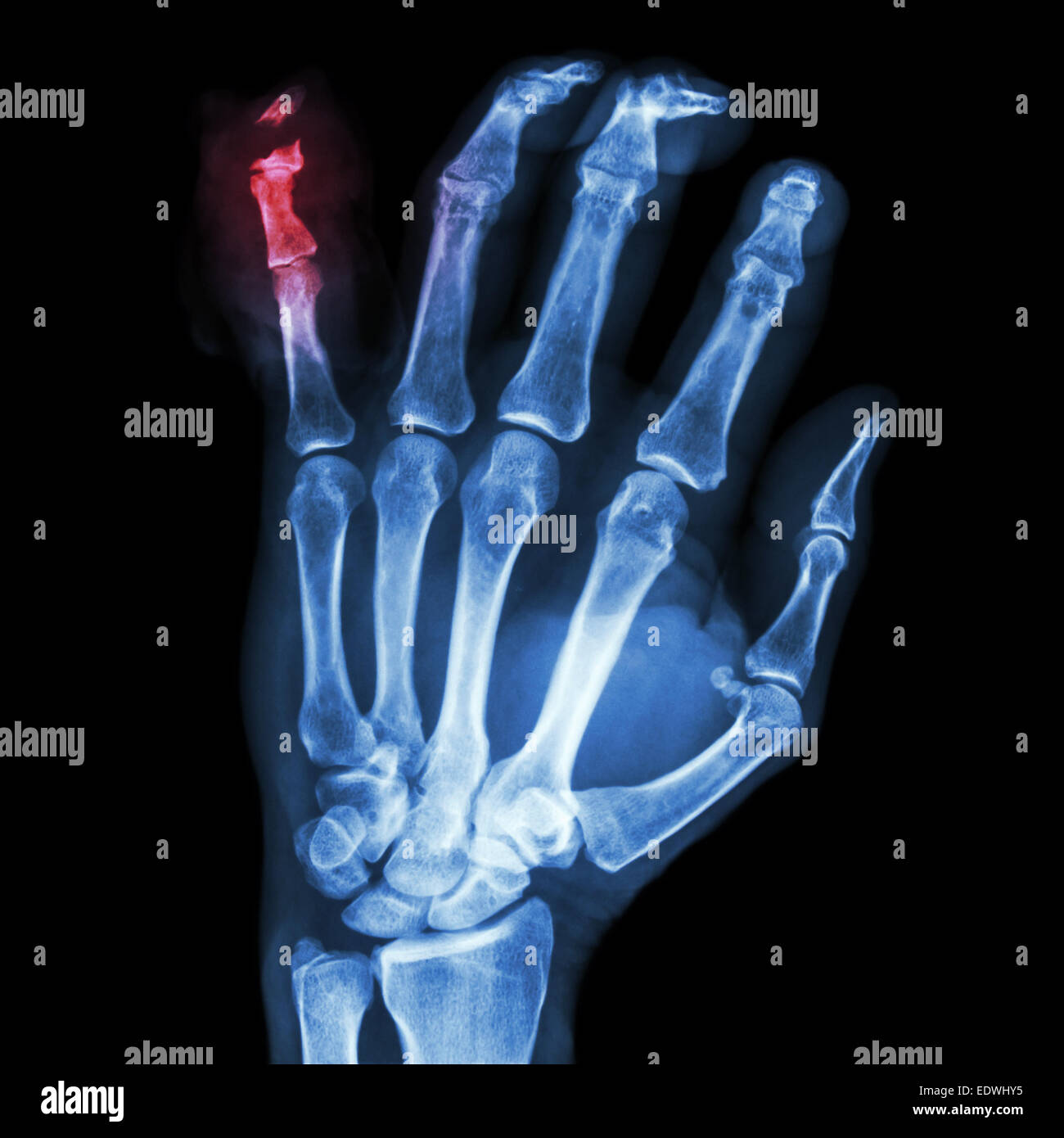 My Image 28