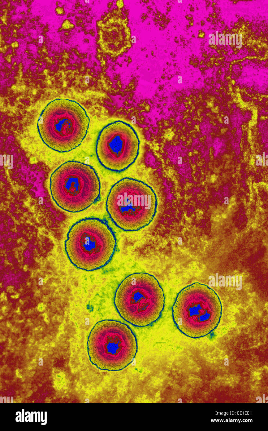 HERPES SIMPLEX VIRUS Stock Photo - Alamy