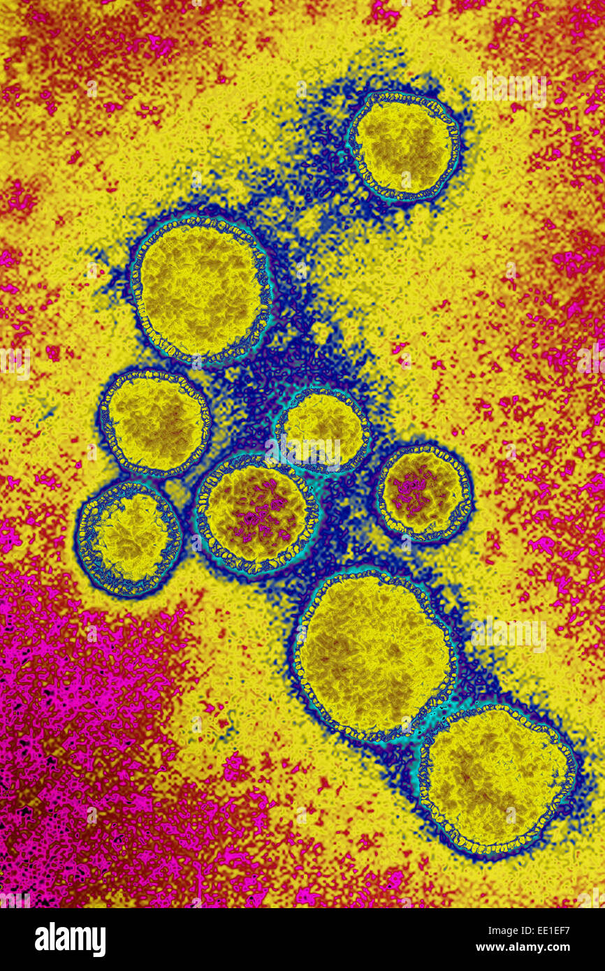 RESPIRATORY SYNCYTIAL VIRUS Stock Photo Alamy