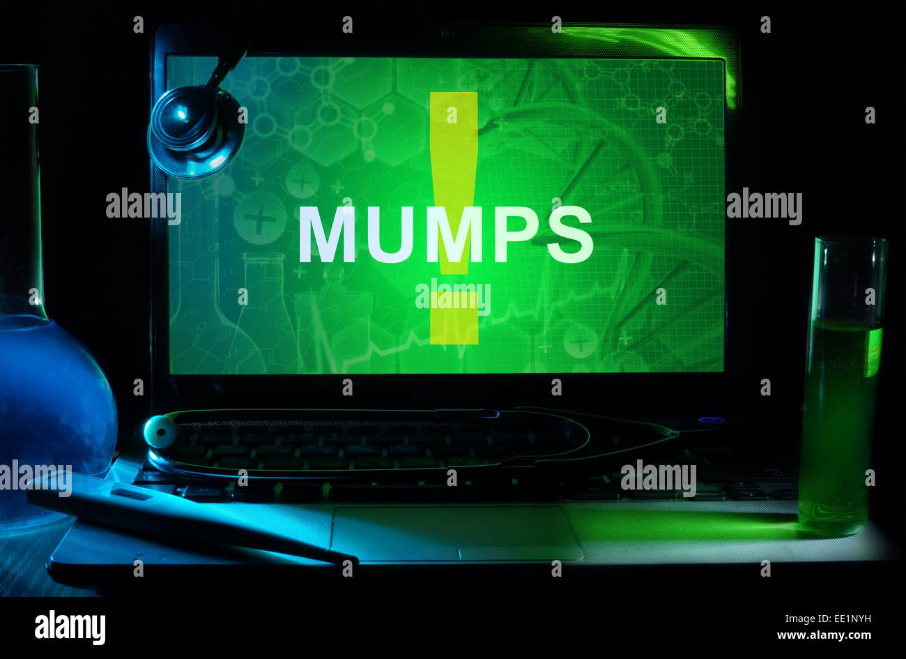 Notebook with words Mumps, test tubes and stethoscope Stock Photo Alamy