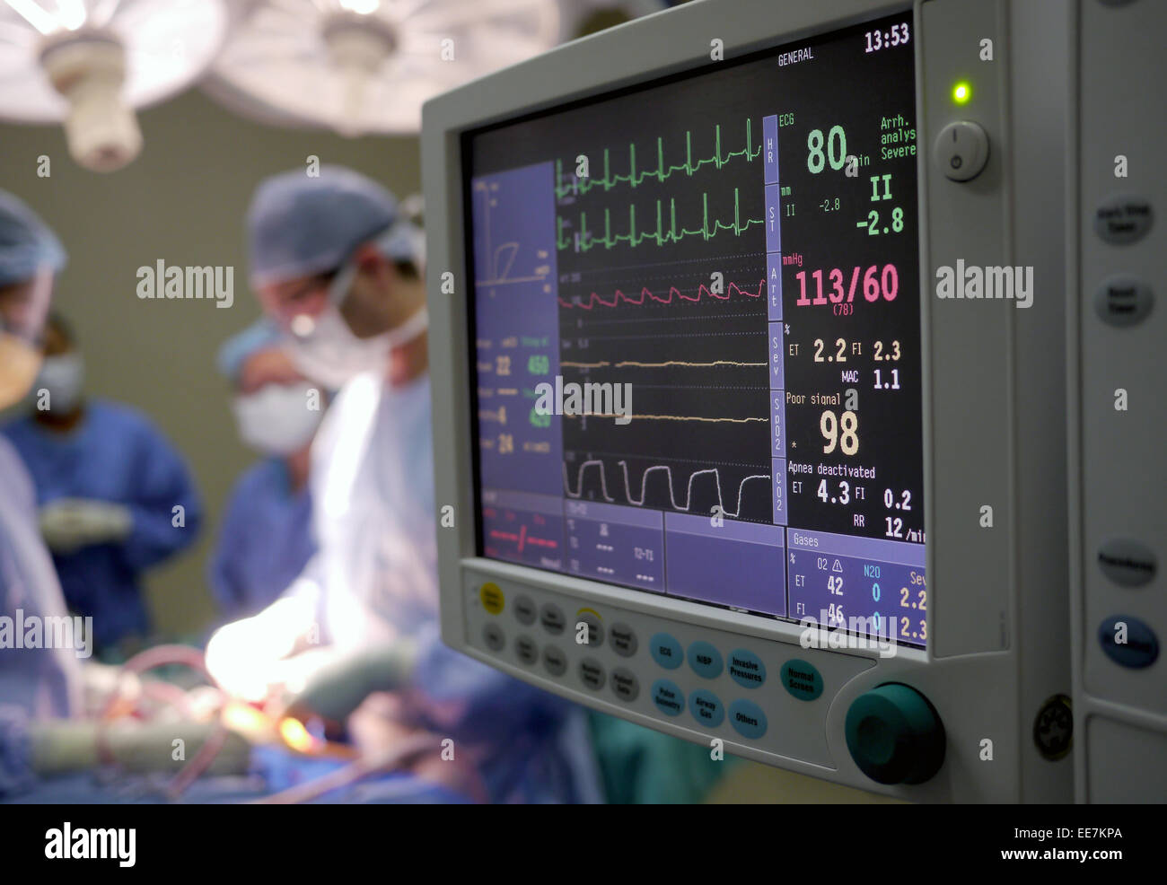 heart monitor in hospital Stock Photo