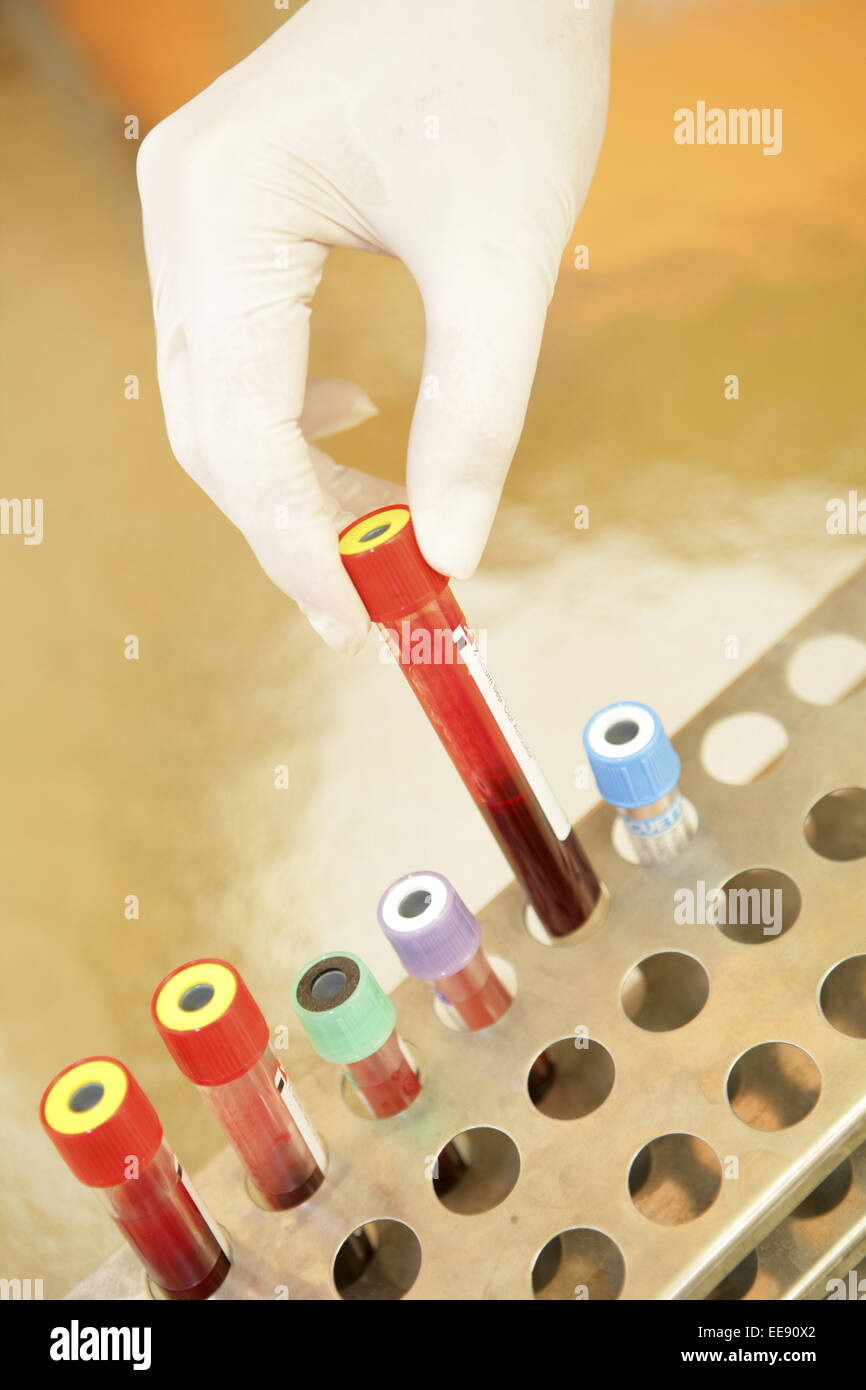 Bluttest, Blutuntersuchung, Blutuntersuchungen, Blutprobe, Blutproben, Forschen, Forscher ...