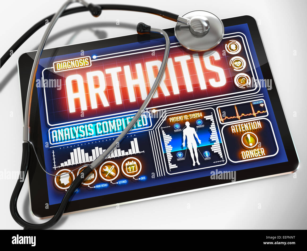 Arthritis on the Display of Medical Tablet. Stock Photo