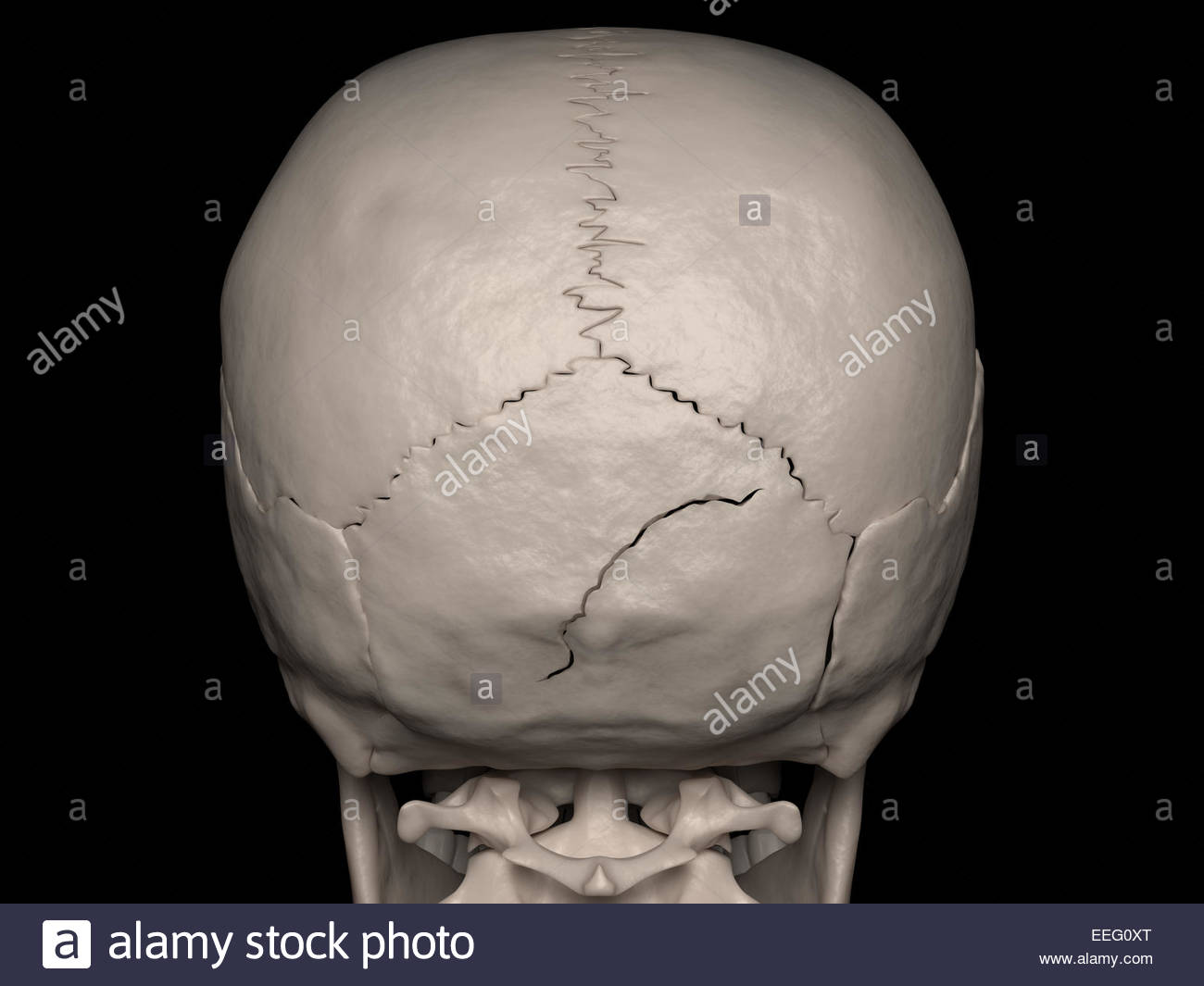 Digital medical illustration depicting a linear cranial vault Stock