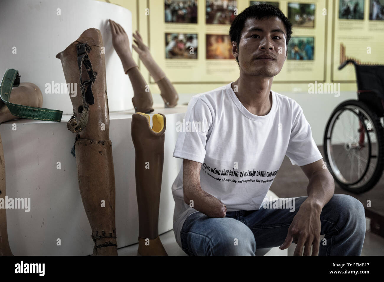 Tuan Nguyen lost his hand while handling an explosive hidden since the war. Stock Photo