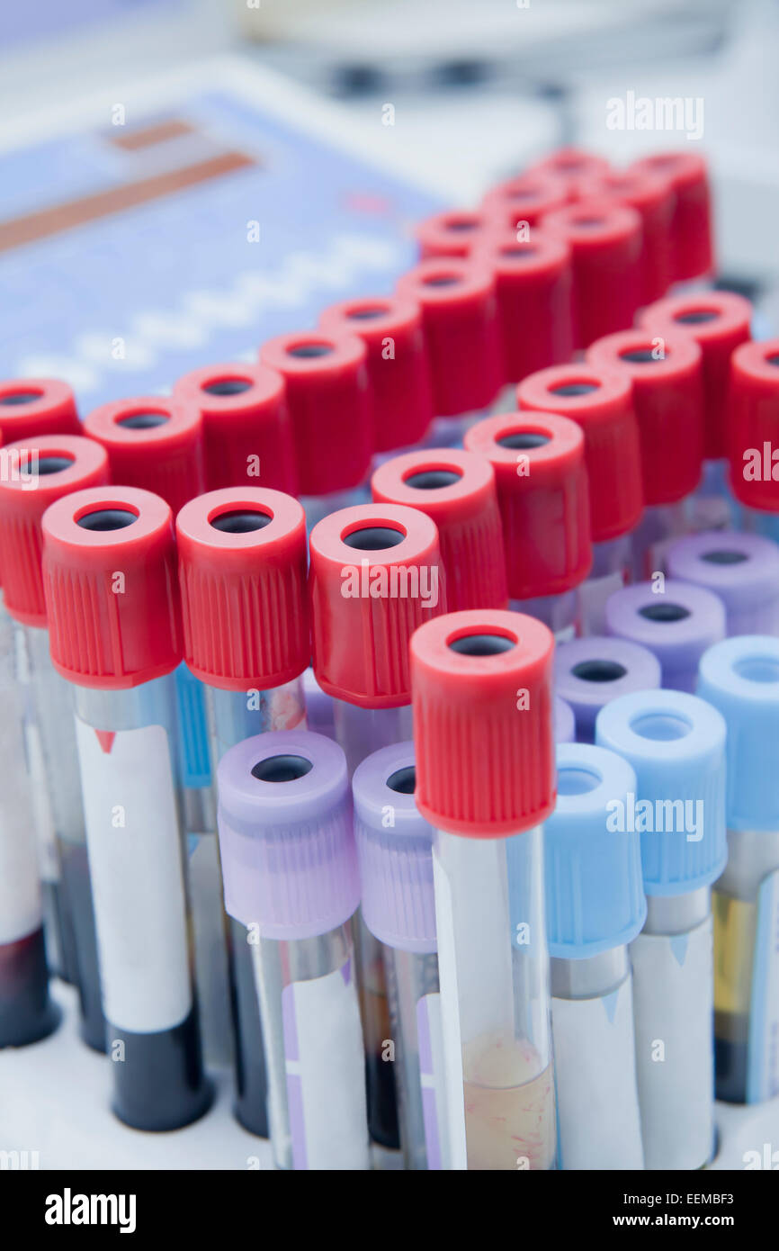 Close up of blood samples in test tube rack in laboratory Stock Photo