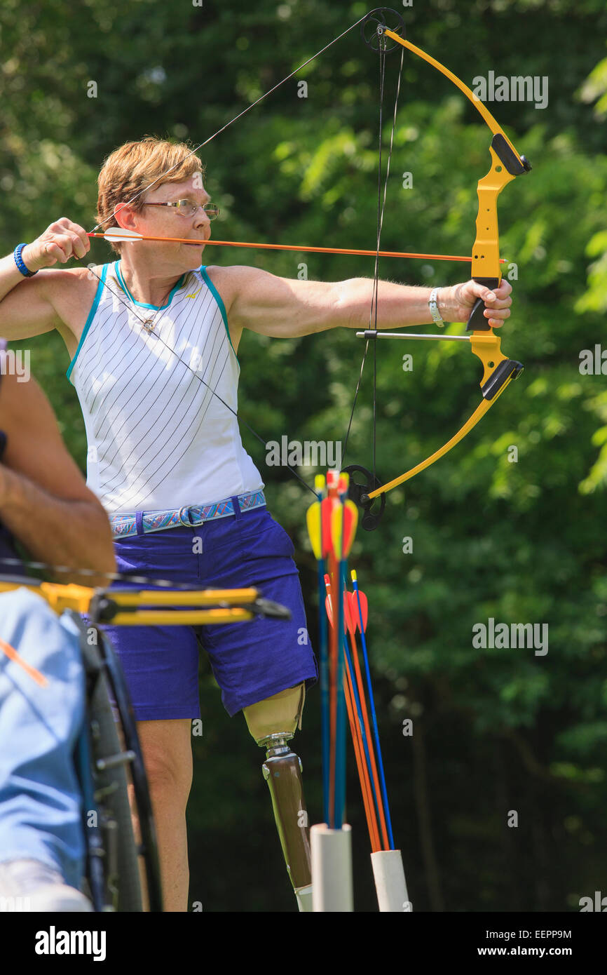 Man with spinal cord injury and woman with prosthetic leg during