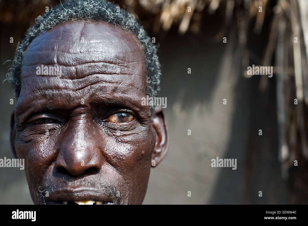 Man belonging to the Nuer tribe with traditional scarifications on the forehead. He is a refugee from South Sudan ( Ethiopia) Stock Photo