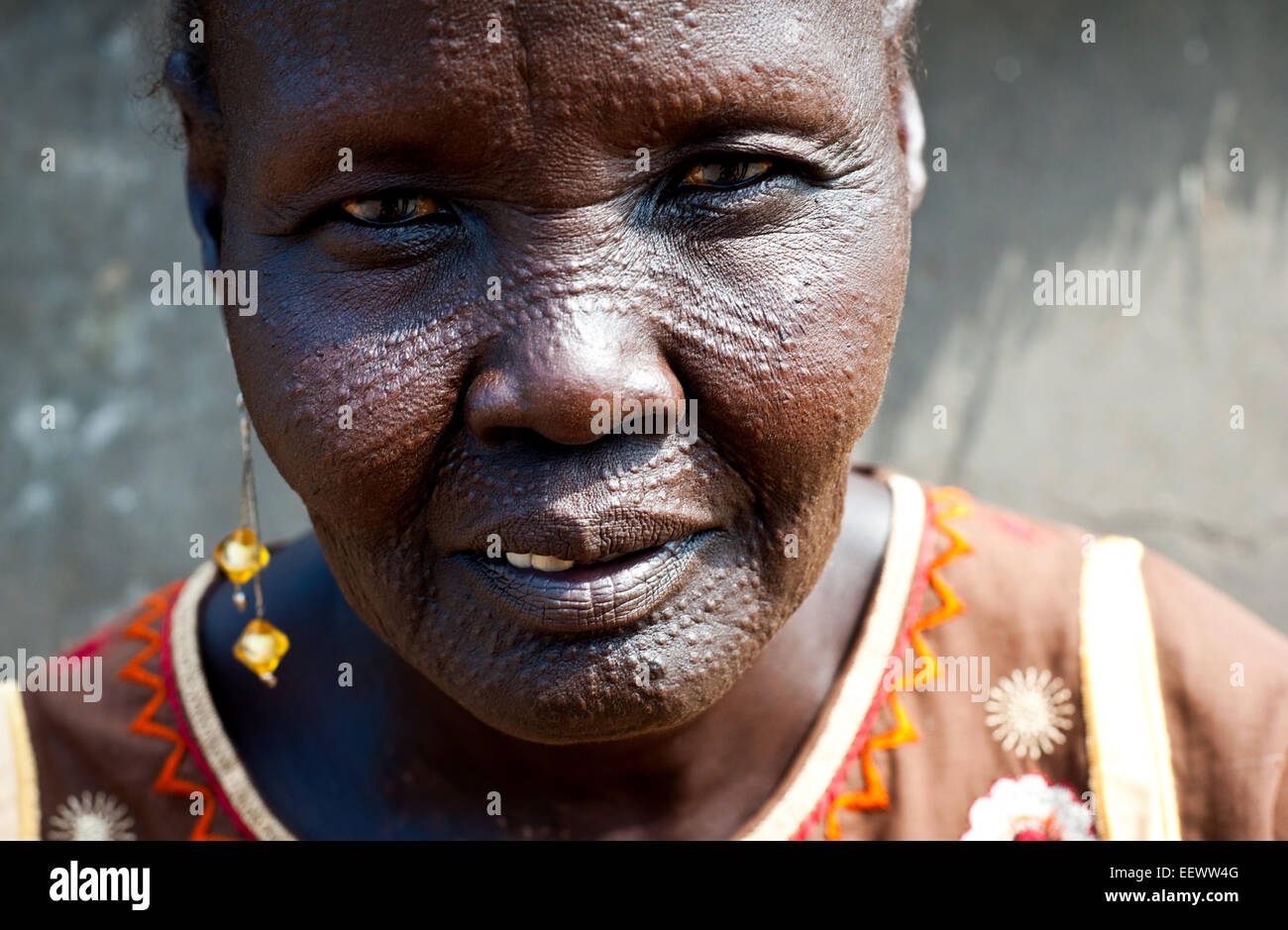 Woman belonging to the Nuer tribe with facial markings on the head. She is a refugee from South Sudan ( Ethiopia) Stock Photo