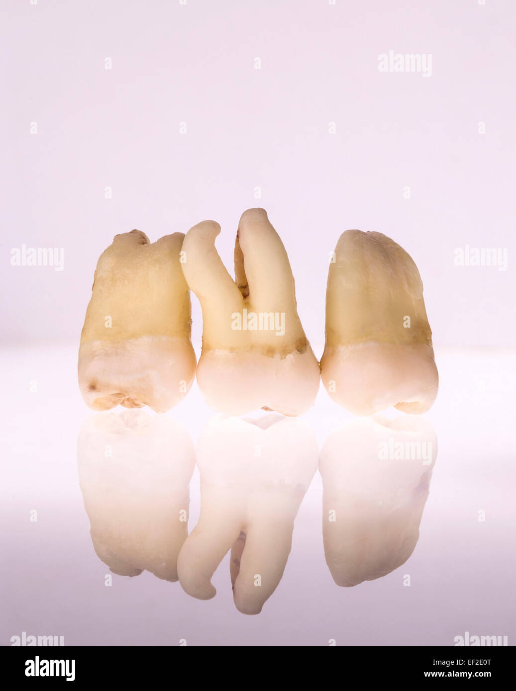 Group of extracted teeth with reflection below. Stock Photo