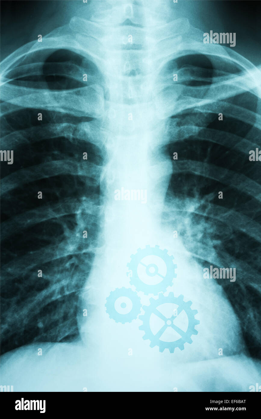 X-Ray Photo Of Human Showing Working Heart With Cog Wheels Stock Photo