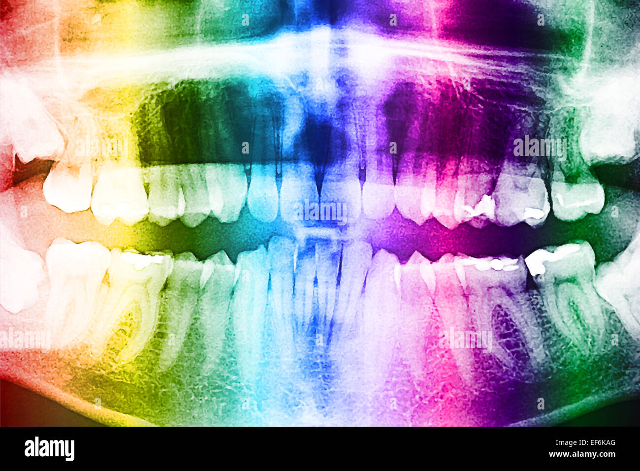 Skull with teeth hires stock photography and images Alamy