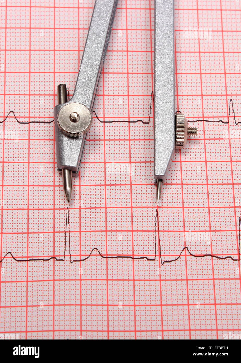 Electrocardiogram graph and calipers, ekg heart rhythm, medicine