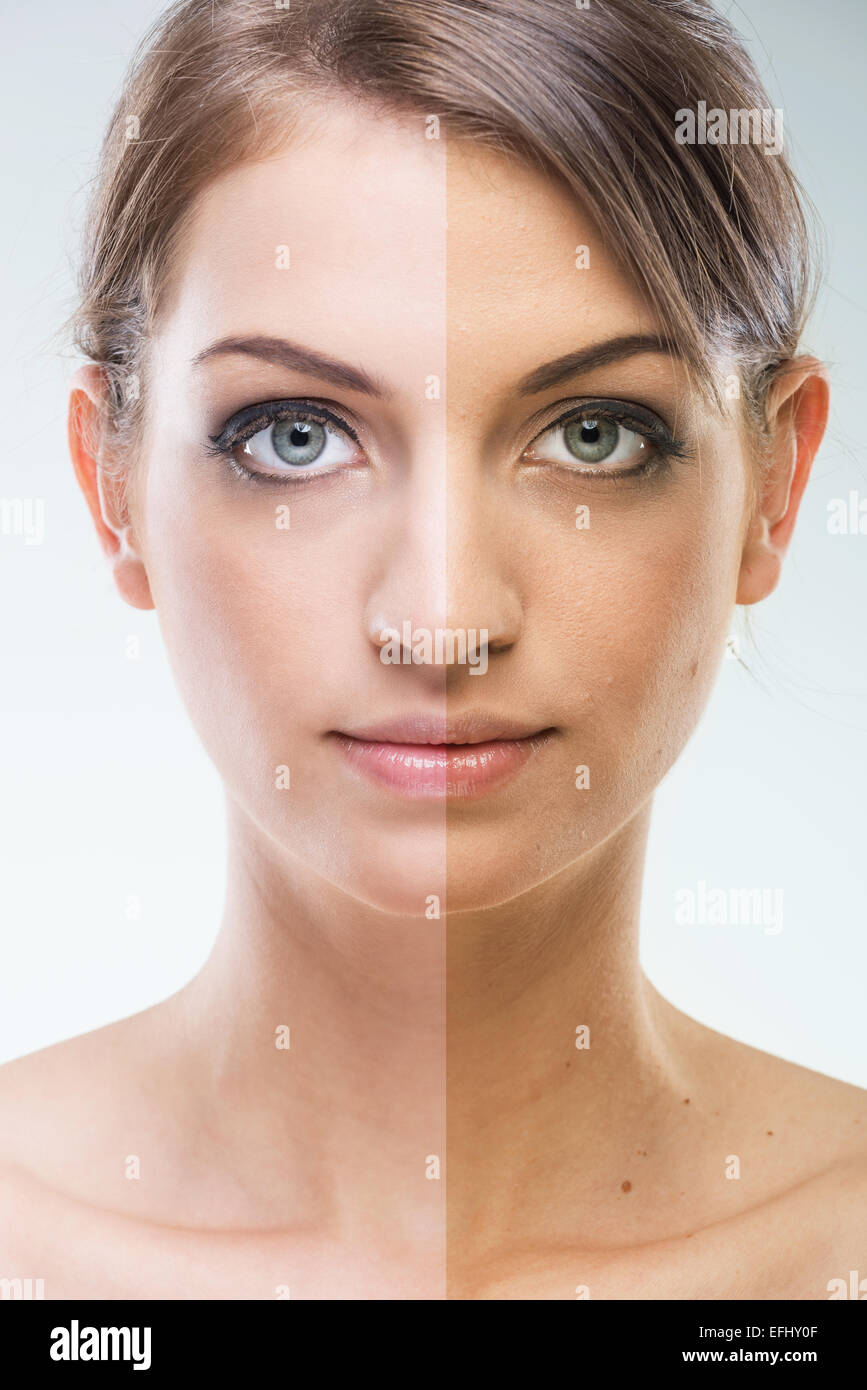 Before After Plastic surgery face before and after tanning Stock