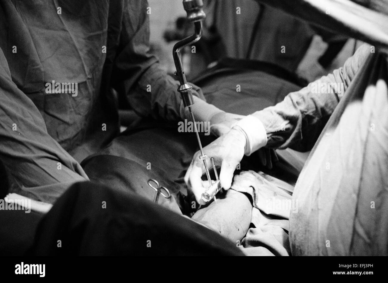 Leg external fixator hi-res stock photography and images - Alamy