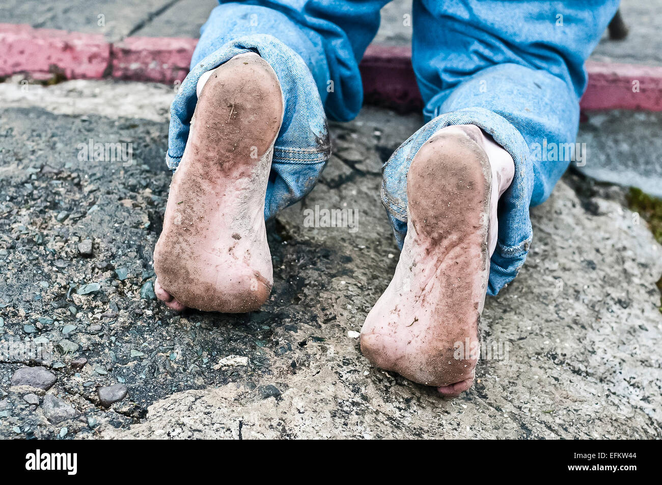 The feet of a man who has just climbed Croagh Patrick barefoot as he prays at the top Stock