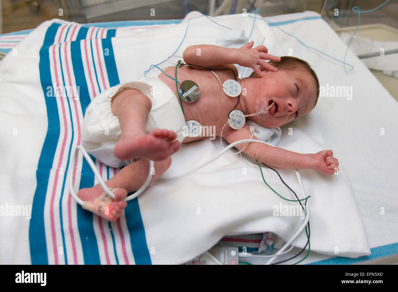 preemie crying