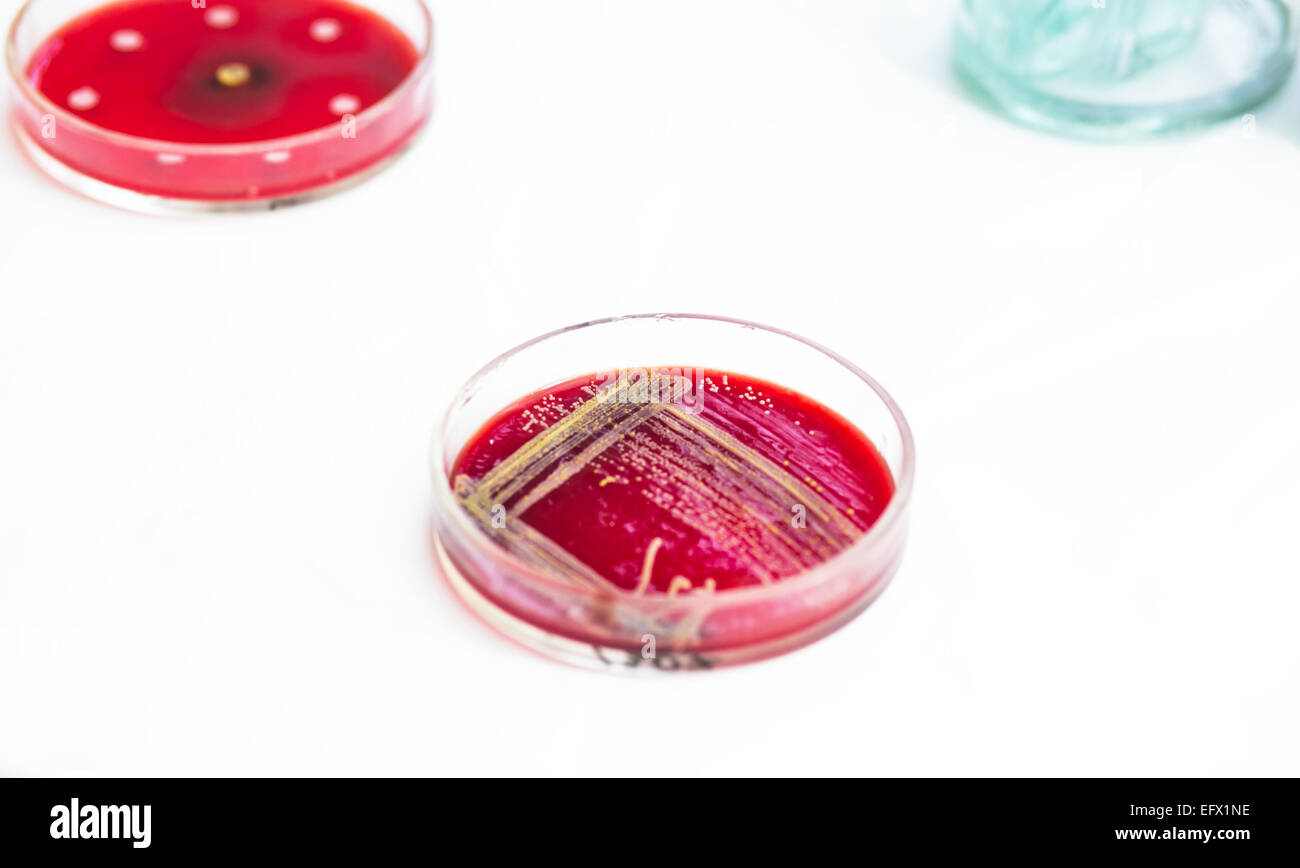 Two Petri dishes with bacteria growing in them Stock Photo