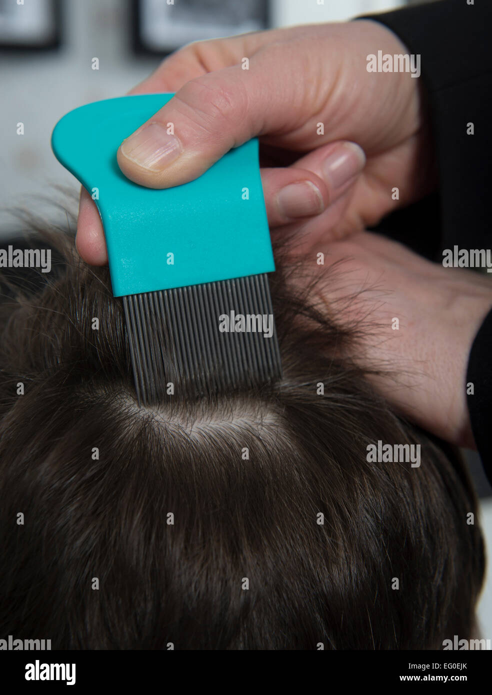 Hair For Head Lice Hi Res Stock Photography And Images Alamy