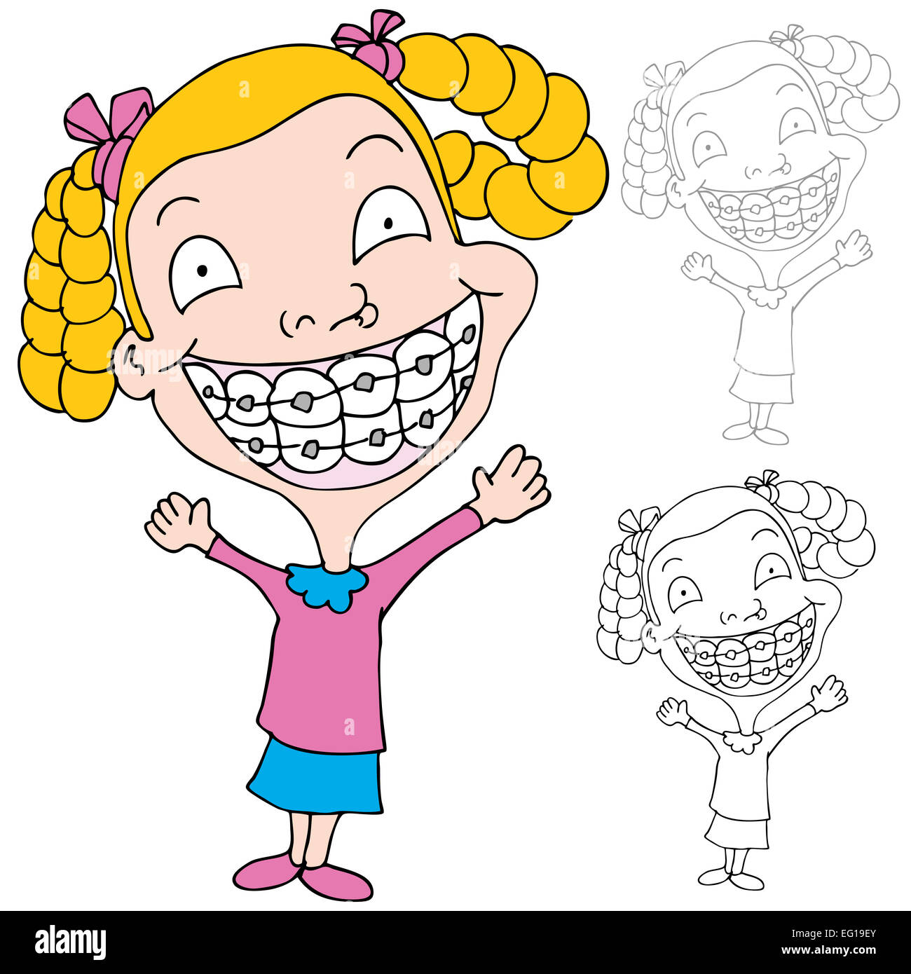 An image of a girl wearing braces Stock Photo - Alamy