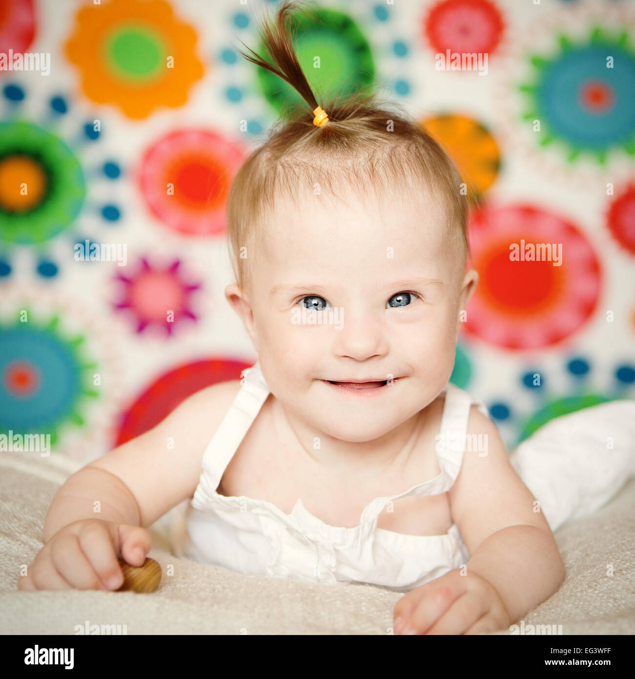 little girl with Down syndrome Stock Photo