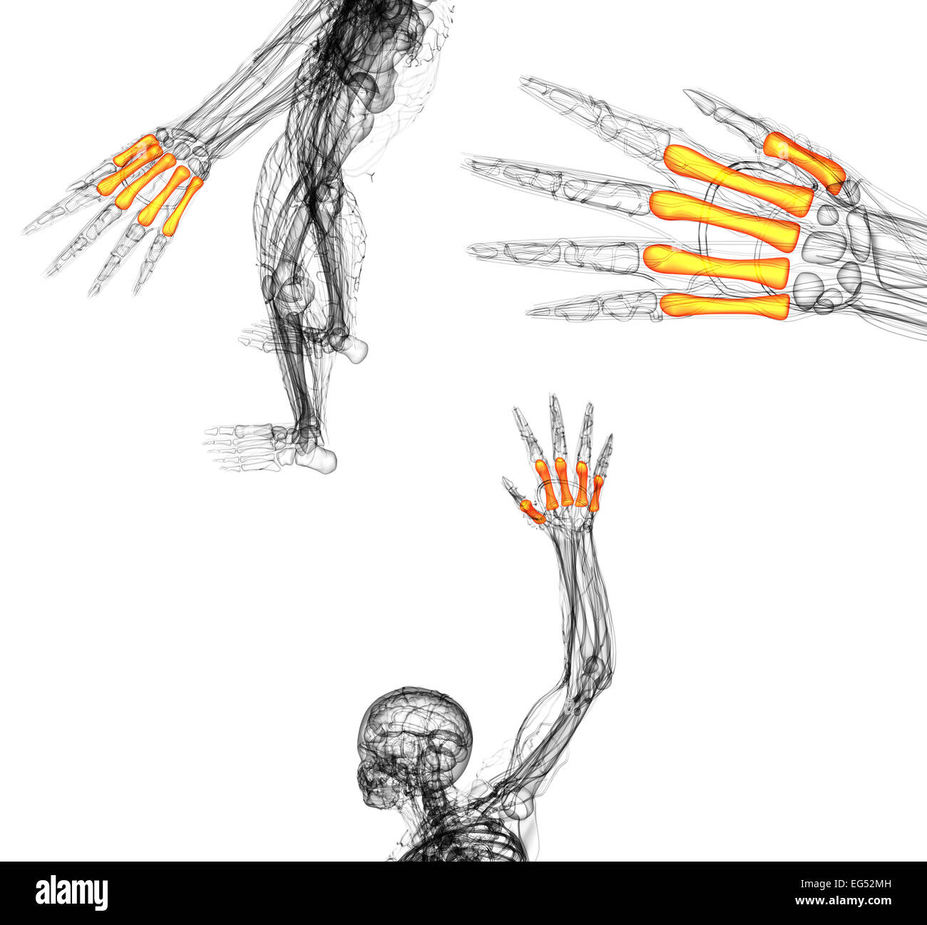 3d render medical illustration of the metacarpal bone Stock Photo