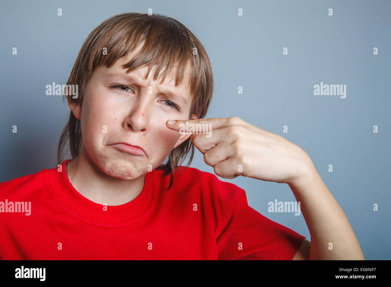 European-looking boy of ten years pimple on the nose, upset over Stock Photo