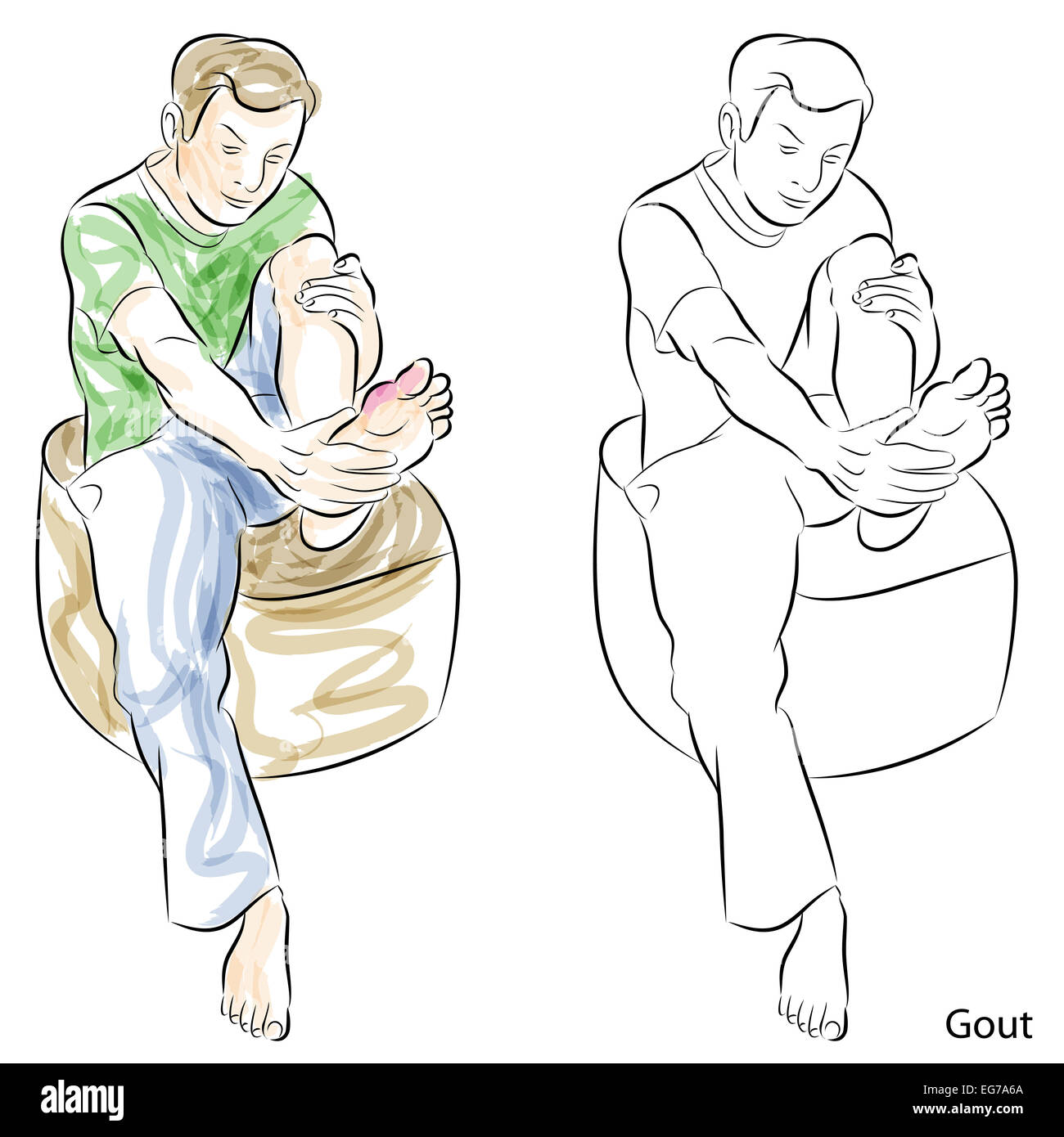 An image of a man massaging gout feet. Stock Photo