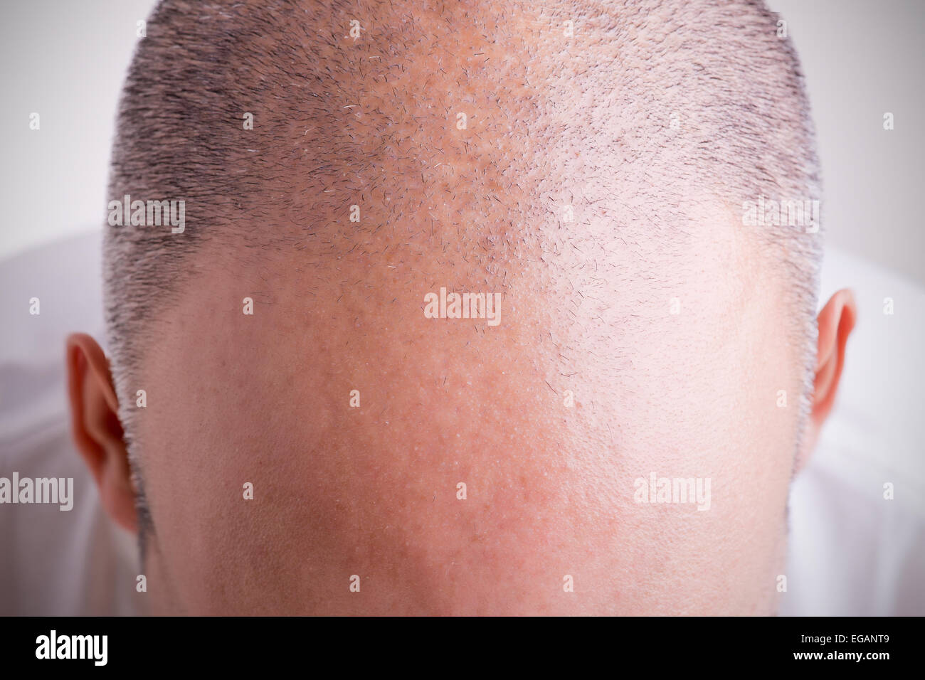Top view of a men's head with a receding hair line Stock Photo