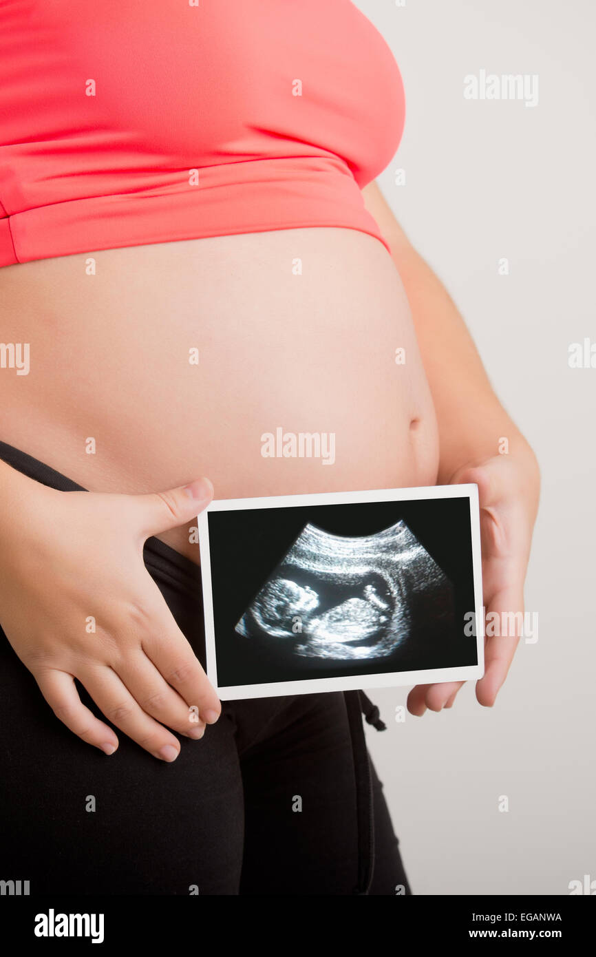 Woman holding an ultrasound scan of her unborn baby Stock Photo