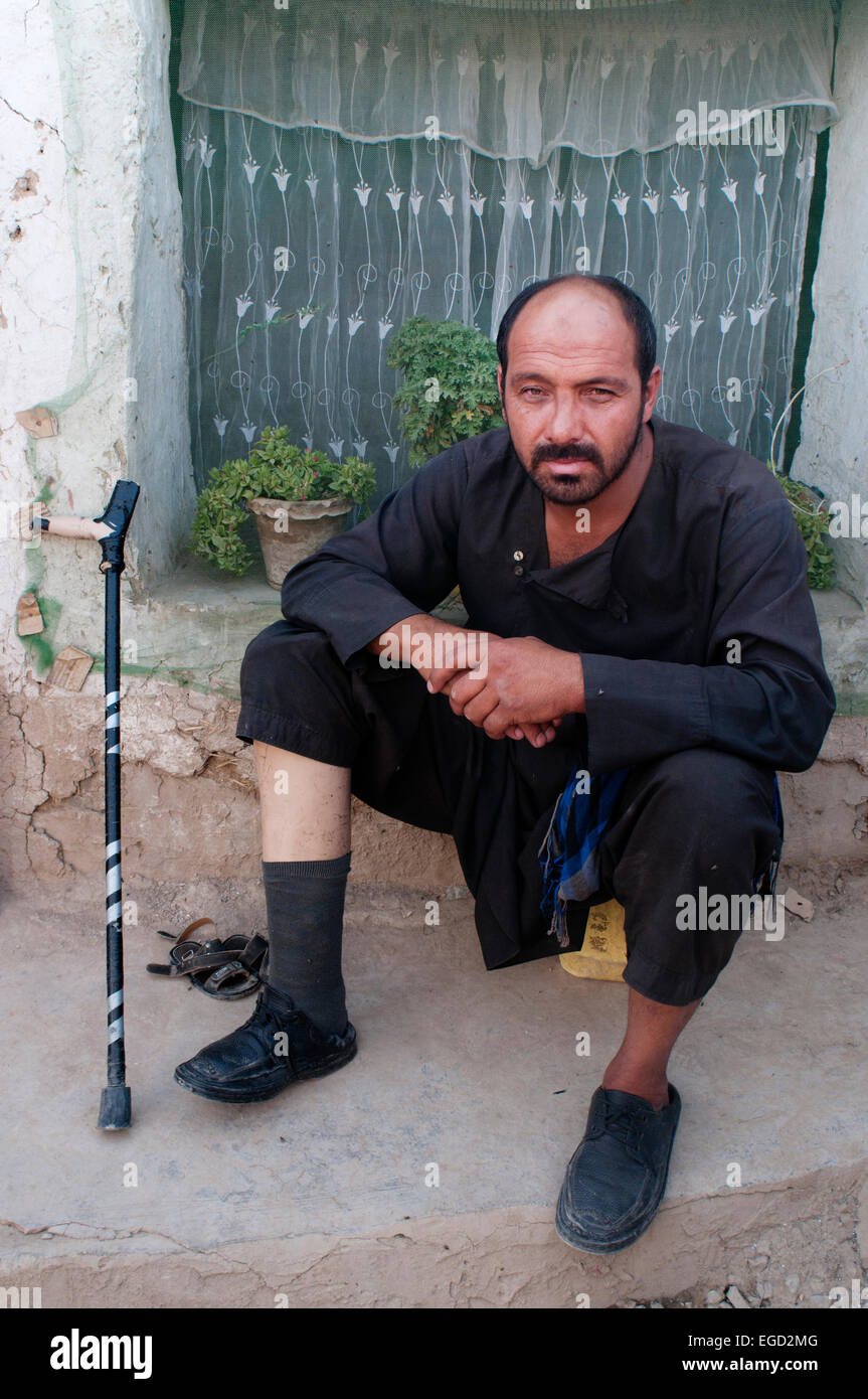 Amidullah (39)  Charahi Spinkali, Kabul . Disabled since he  stepped on a landmine 20 years ago when he was a soldier Stock Photo