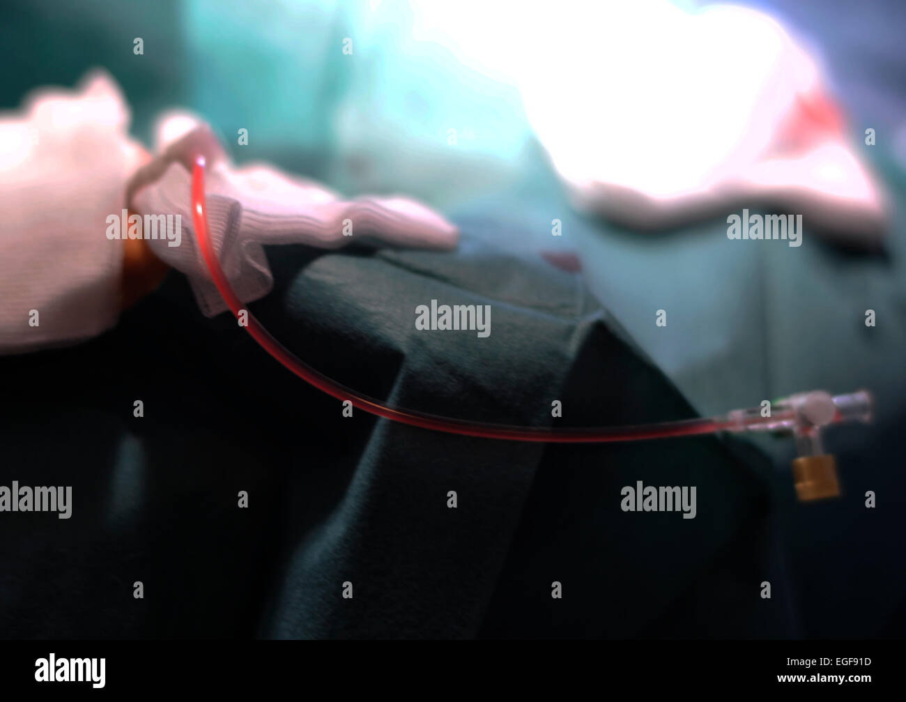 Cardiologists successfully deploy cardiac catheters frequently, a