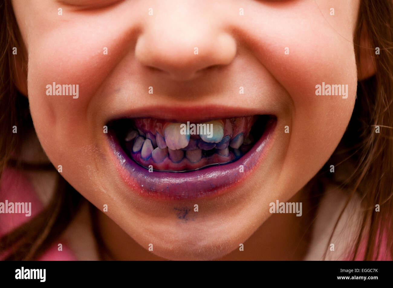 Child using disclosing tablets to show plaque on teeth Stock Photo