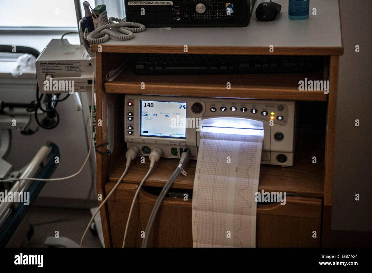 Fetal heart monitor hires stock photography and images Alamy