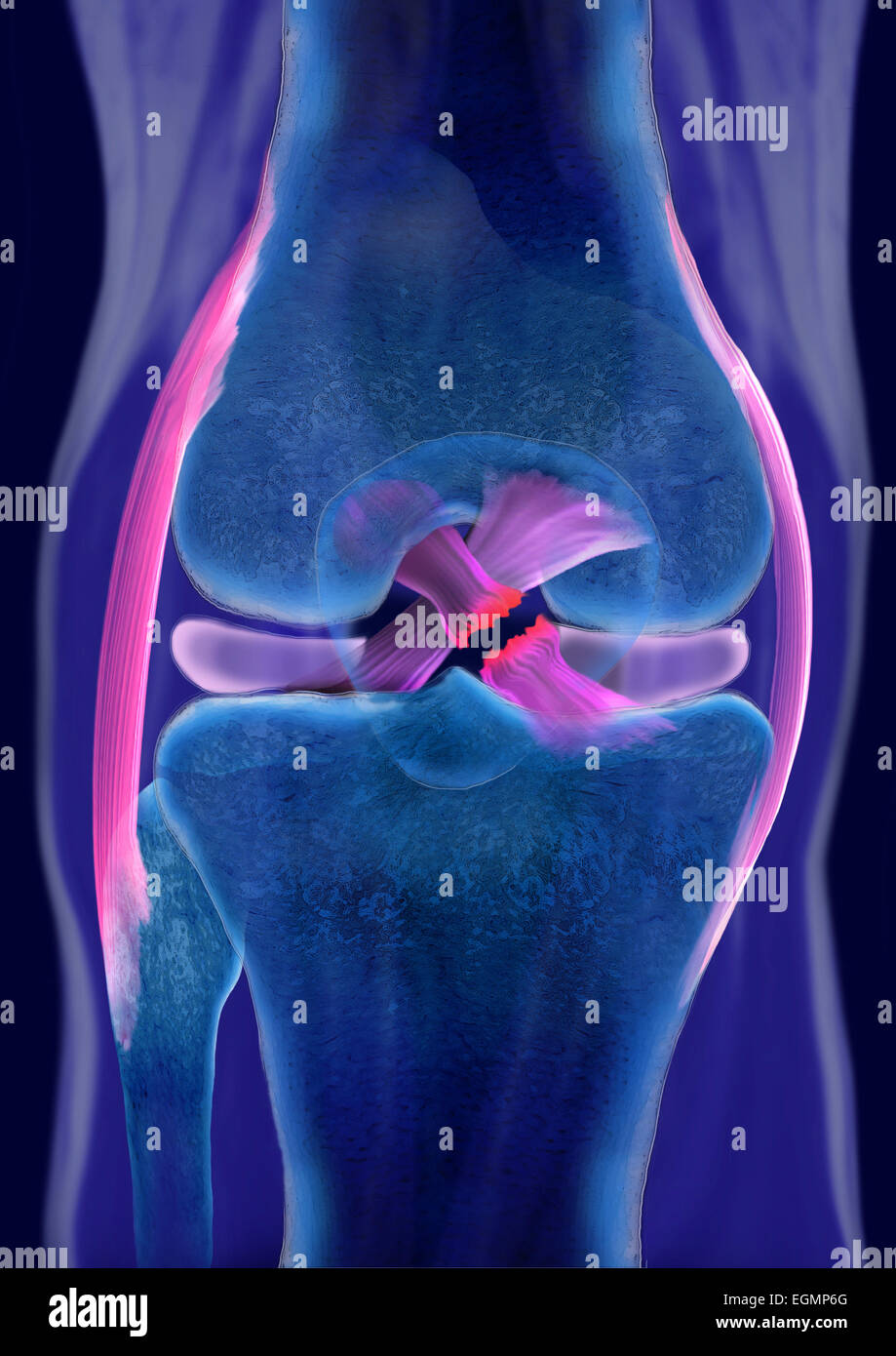 Cruciate ligament rupture hires stock photography and images Alamy