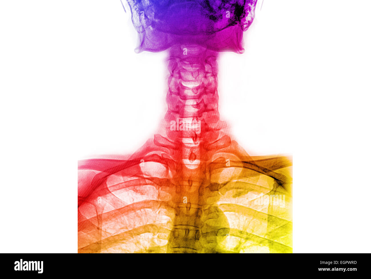 Anatomy of lumbar spine hi-res stock photography and images - Alamy