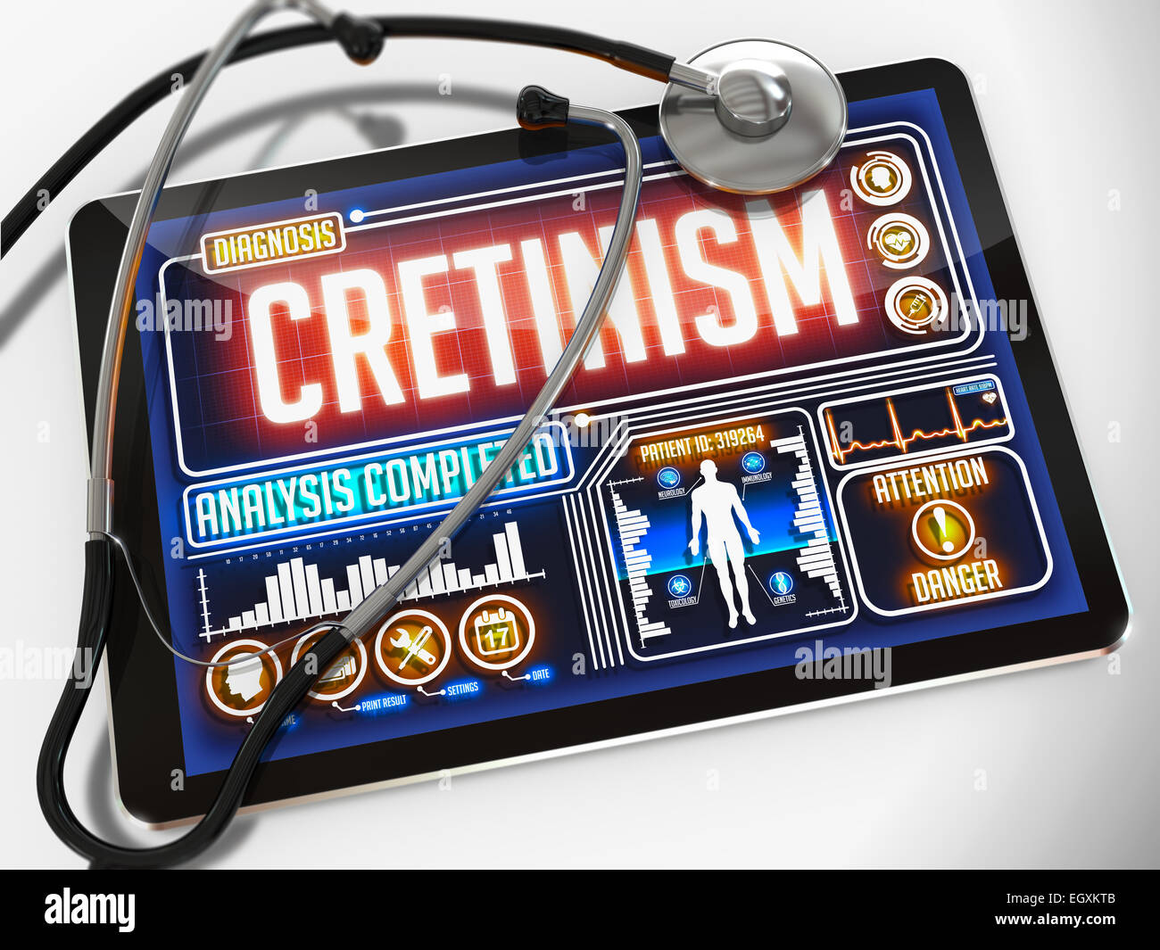 Cretinism Hi Res Stock Photography And Images Alamy