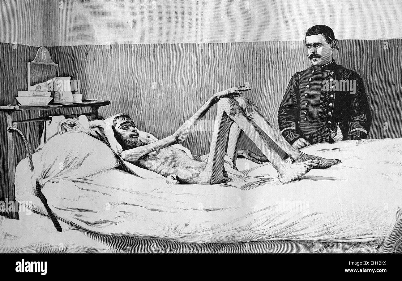 Famine in Algeria, a man rescued from starvation in the hospital of Milianah, historical illustration circa 1893 Stock Photo