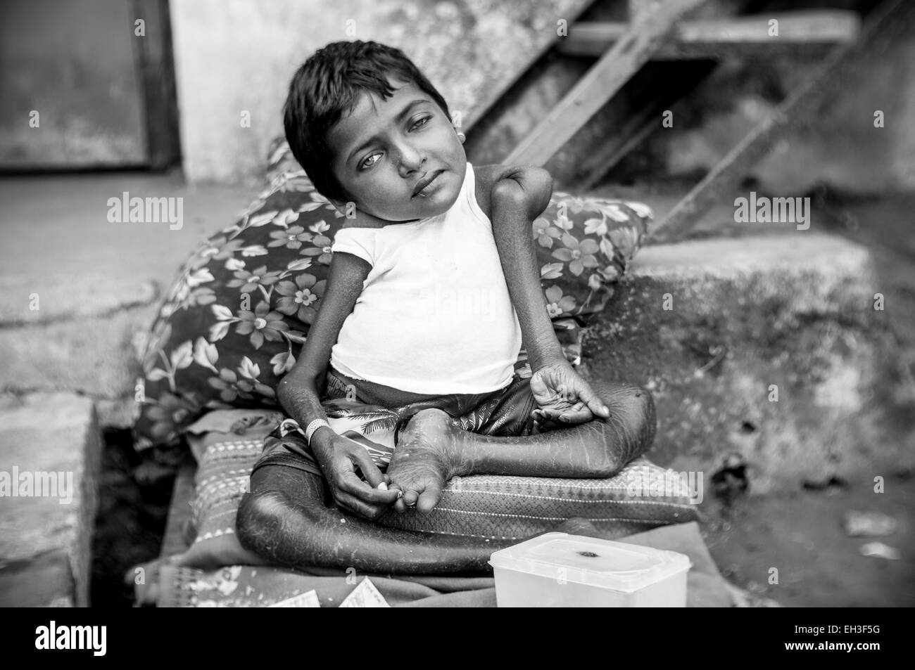 A small homeless girl, severely disabled, begging for money in rural India. Stock Photo