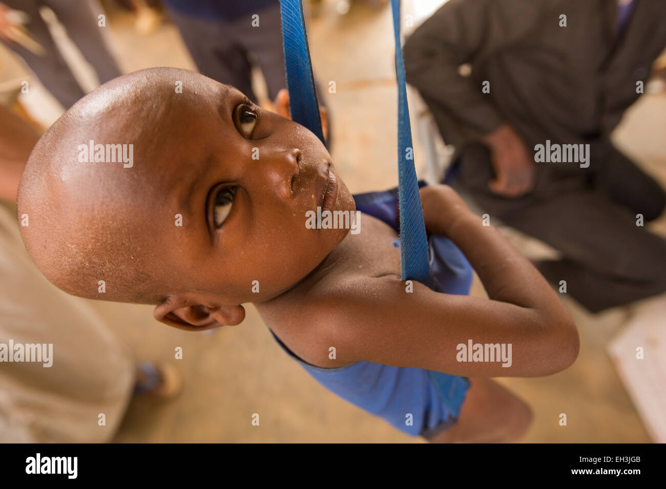 KOMOBANGAU, TILLABERI PROVINCE, NIGER, 15th May 2012: A child with severe malnutition is treated at the local health centre's weekly clinic. Stock Photo