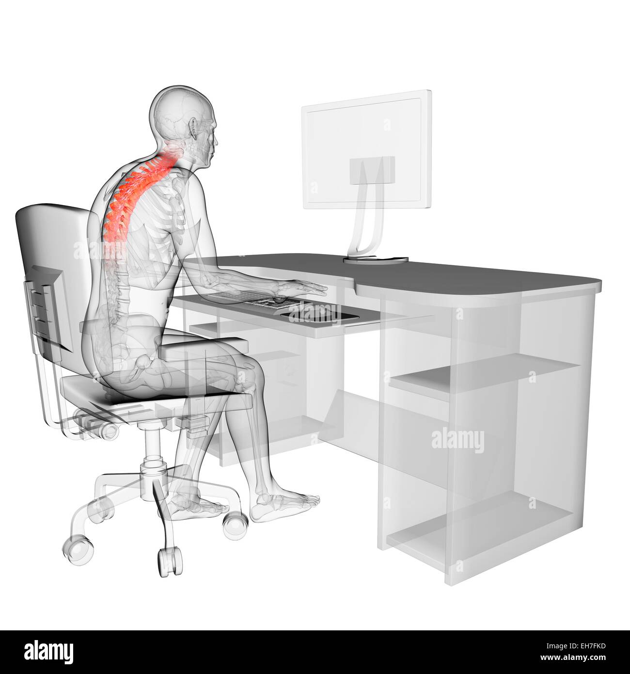 Person Sitting With Incorrect Posture Stock Photo 79456593 Alamy
