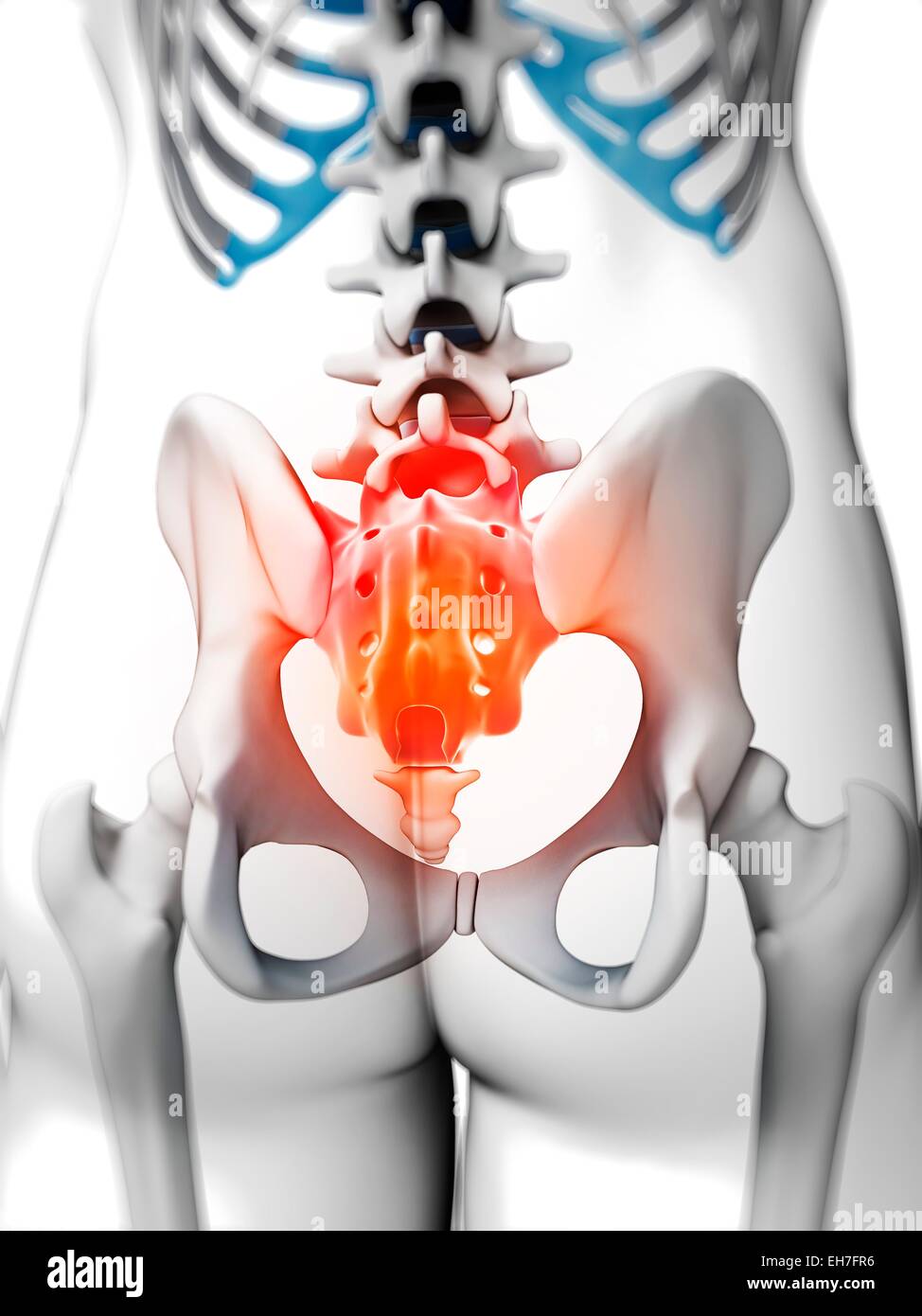 Human back pain, artwork Stock Photo
