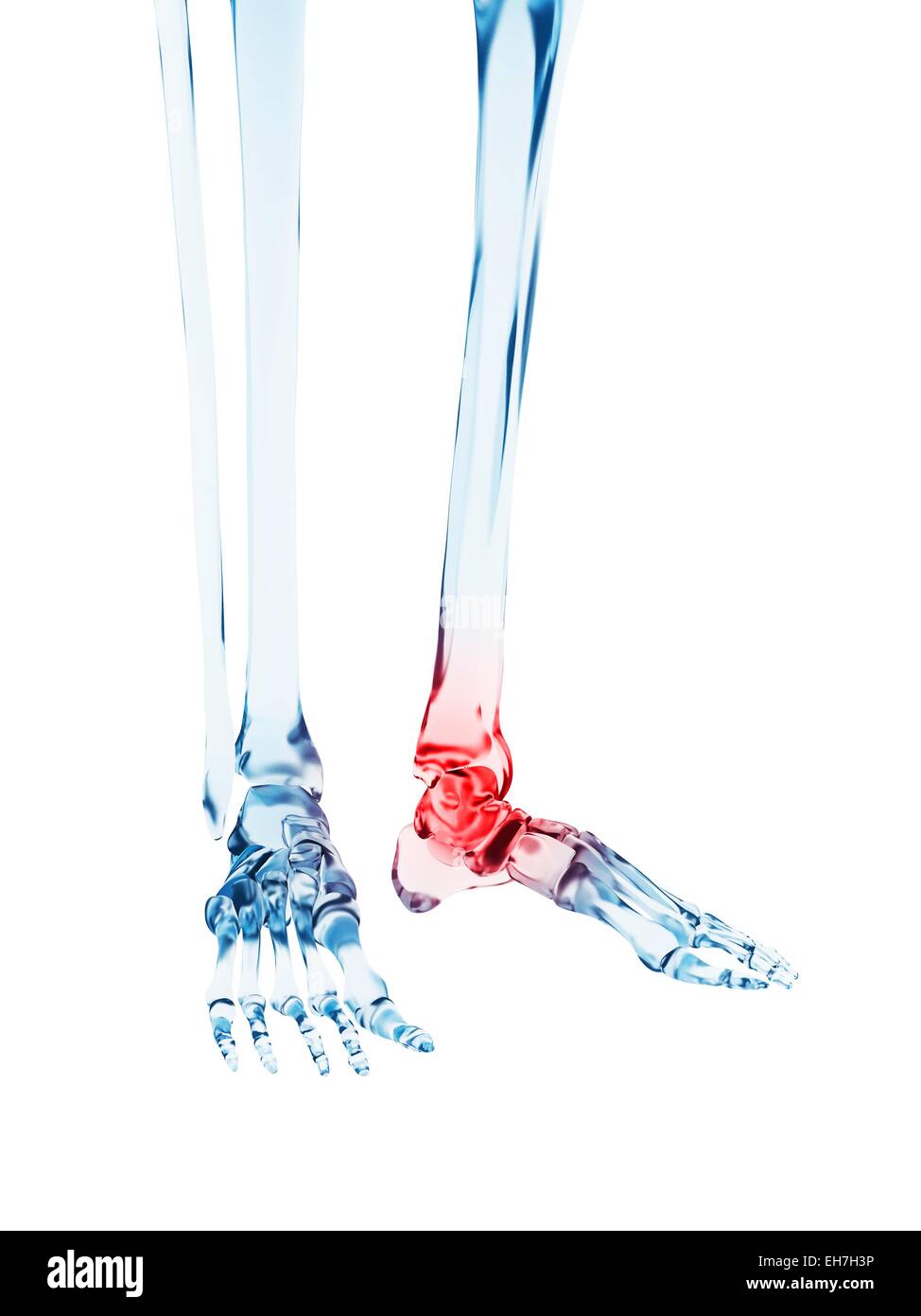 Human ankle pain, illustration Stock Photo - Alamy