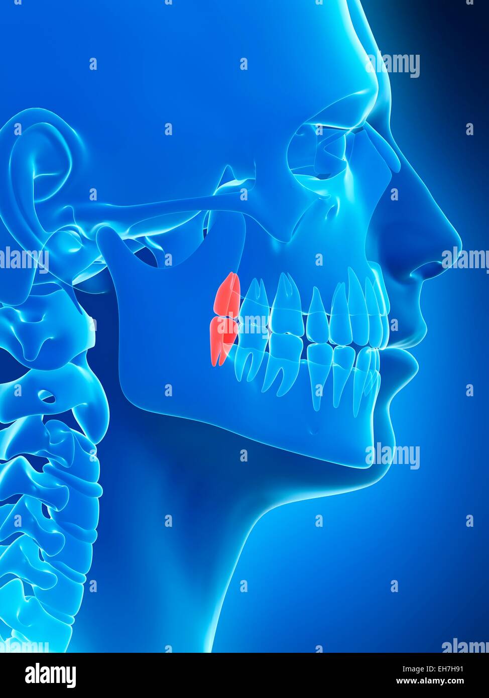 Human wisdom teeth, illustration Stock Photo