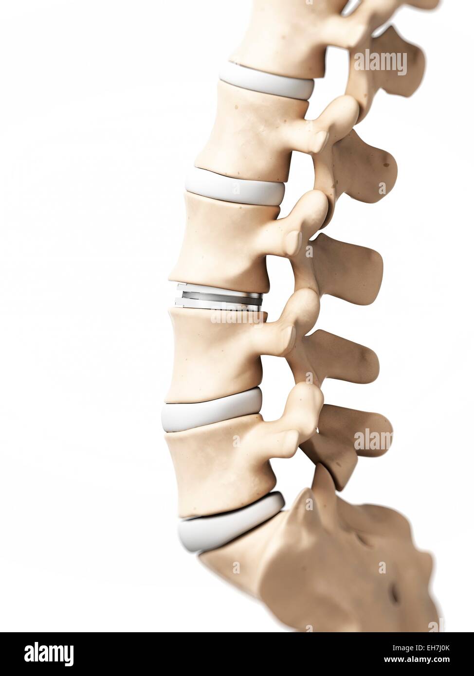Human lumbar spine, illustration Stock Photo