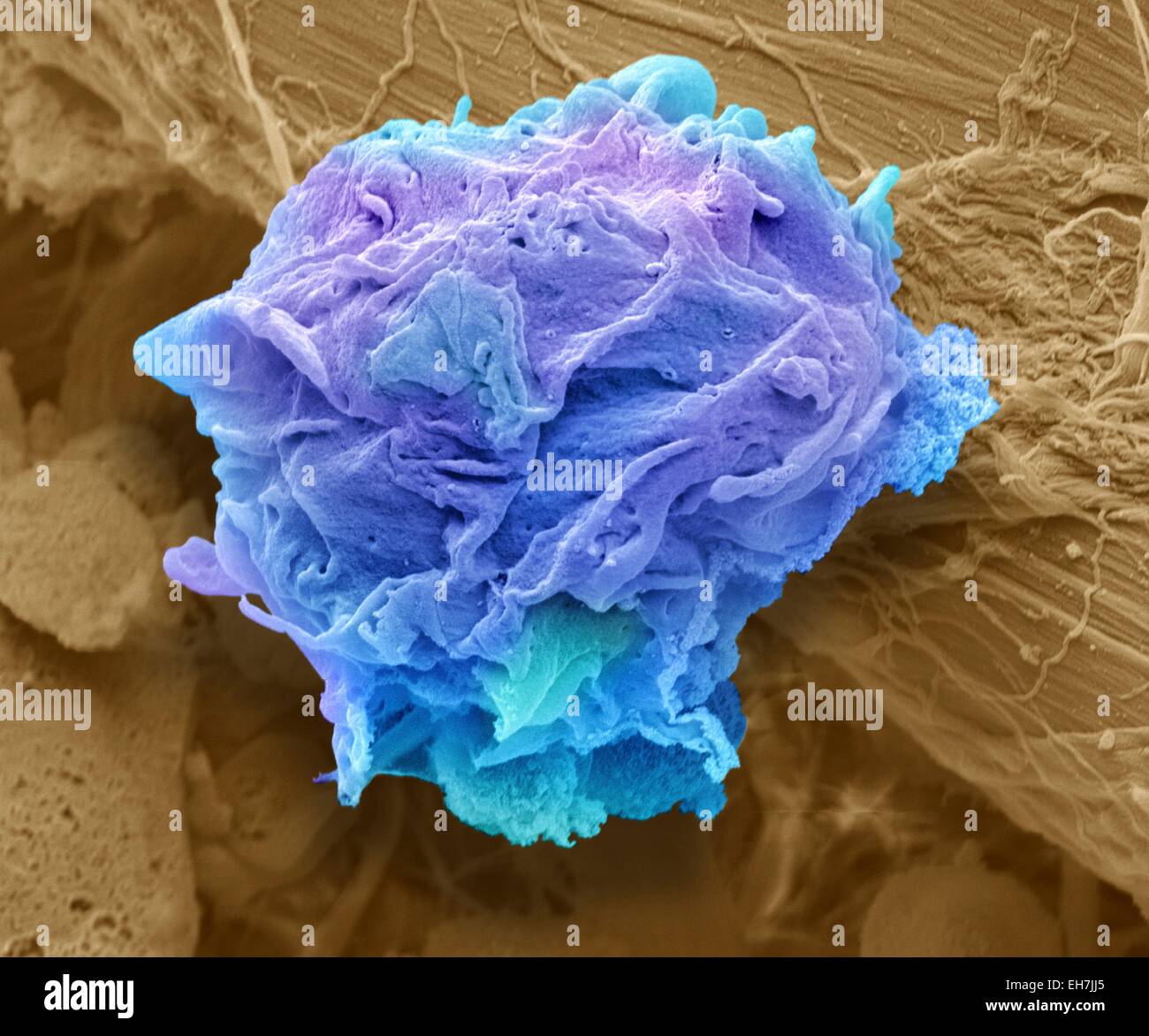 Lymphoma cancer cell, SEM Stock Photo